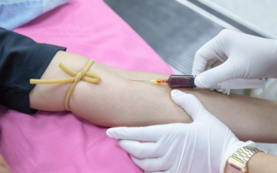 Pesquisa com anticoagulantes tem resultados promissores