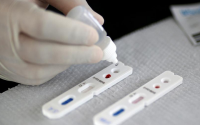 Justiça suspende compra de 100 mil testes para detectar covid-19 no DF