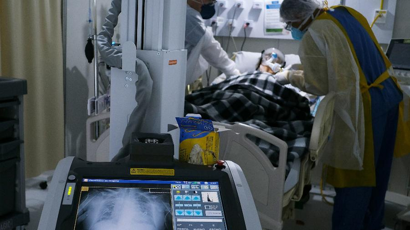 Estudo: uso de radiação nos pulmões pode acelerar recuperação da covid-19