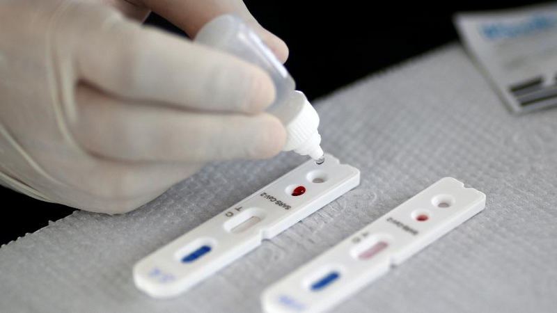 Pesquisadores desenvolvem teste capaz de detectar covid-19 em 20 minutos