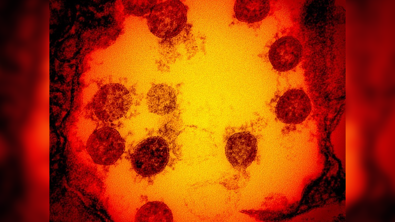 Resultados positivos de testes aumentam as esperanças de uma vacina candidata