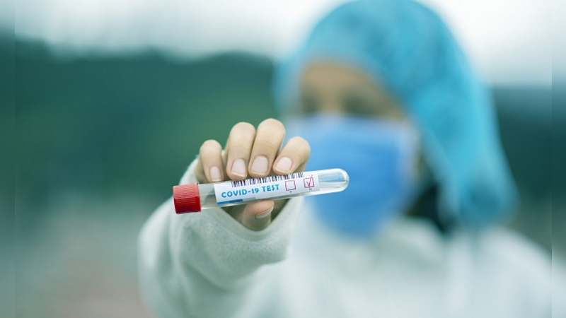 Essenciais para contenção da Covid-19, testes são alvo de desinformação