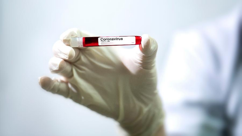 Estudo da FMRP/USP aponta caso de reinfecção