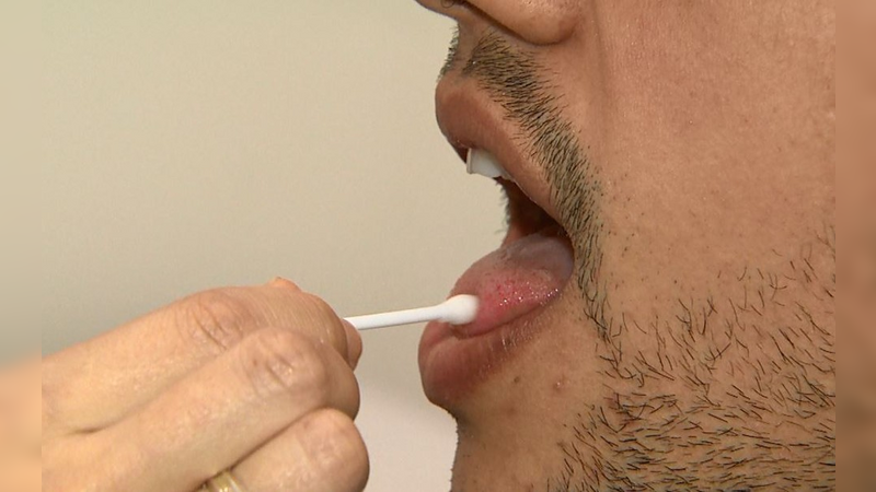 Pesquisa da UnB aponta que 45% dos pacientes com Covid-19 têm perda do paladar